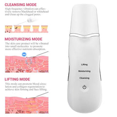 Ultrasonic Leather Shovel – Skin Dirt & Blackhead Remover Peeling Tool