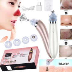 Blackhead Remover Vacuum – Deep Pore Cleaner & Black Spot Removal Device
